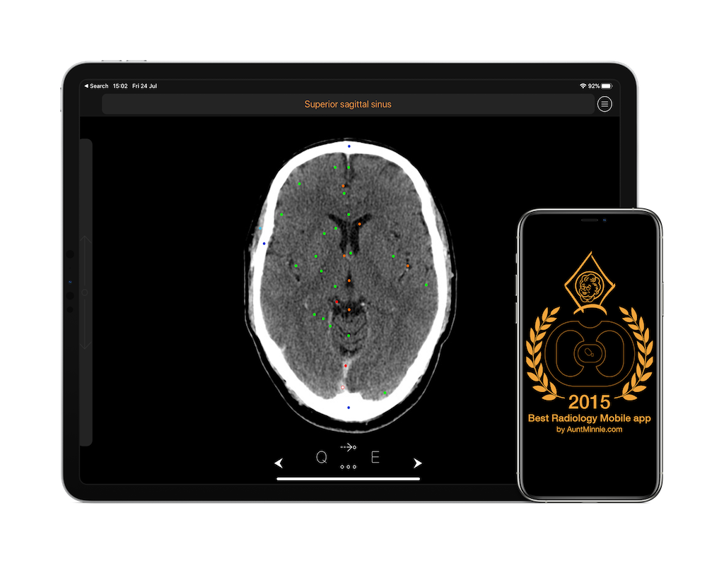 CT Anatomy on iPad