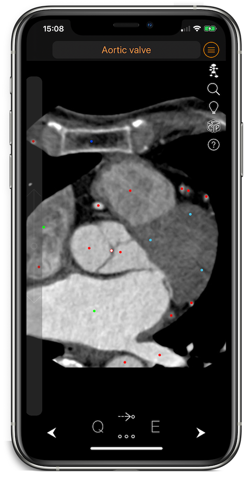 CT Anatomy on iPhone