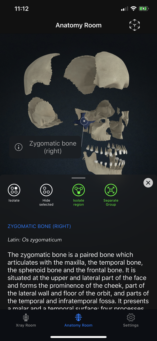 3D anatomy atlas in iRad Xrays