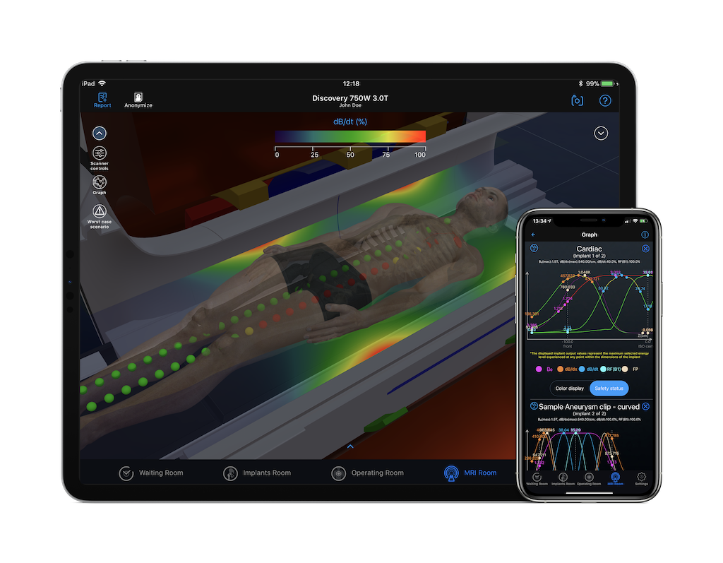 MagnetVision MRI energy field simulation